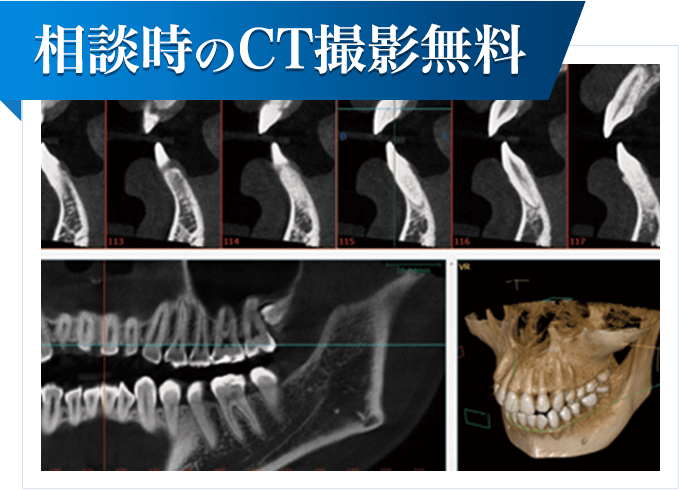 相談時のCT撮影無料